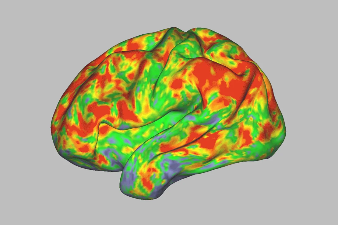 Esto es literal el cerebro en Psilocibina